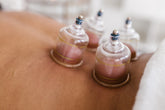 cupping
