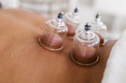 cupping