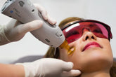 laser hair removal